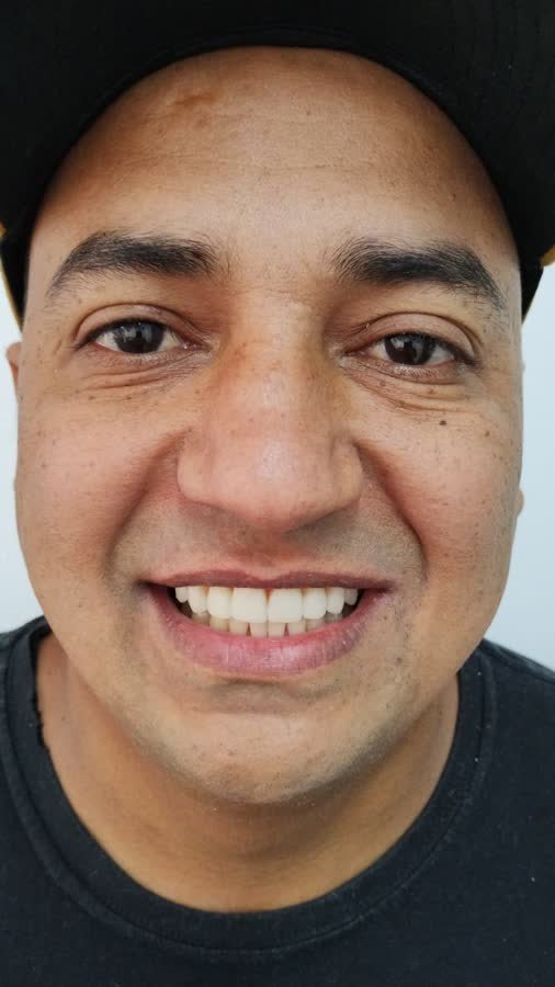 Paciente, caso 1, depois do tratamento