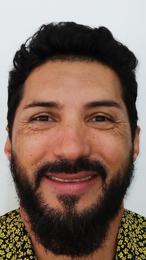 Paciente, caso 2, antes do tratamento