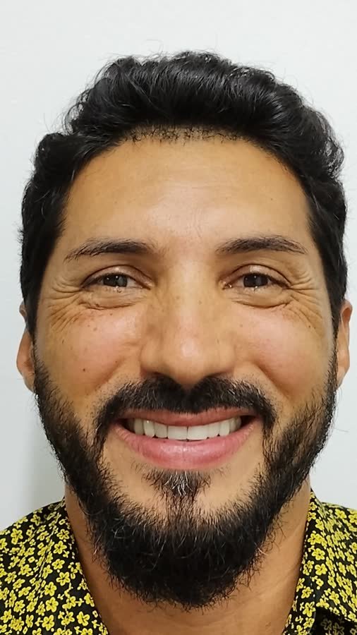 Paciente, caso 2, depois do tratamento