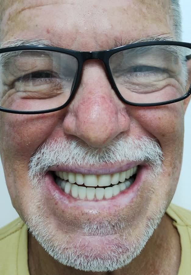Paciente, caso 3, depois do tratamento