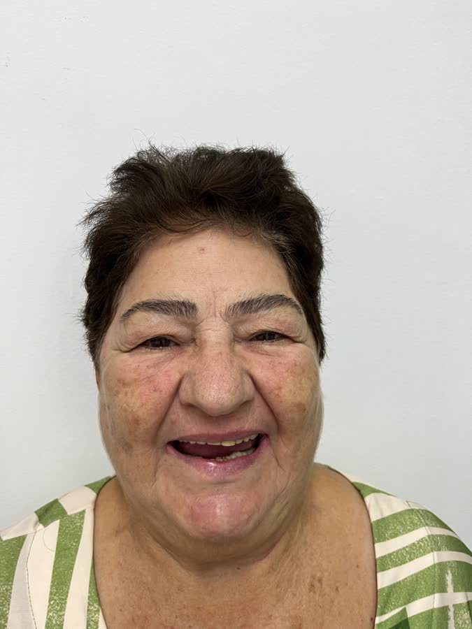 Paciente, caso 5, antes do tratamento
