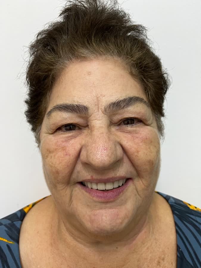 Paciente, caso 5, depois do tratamento