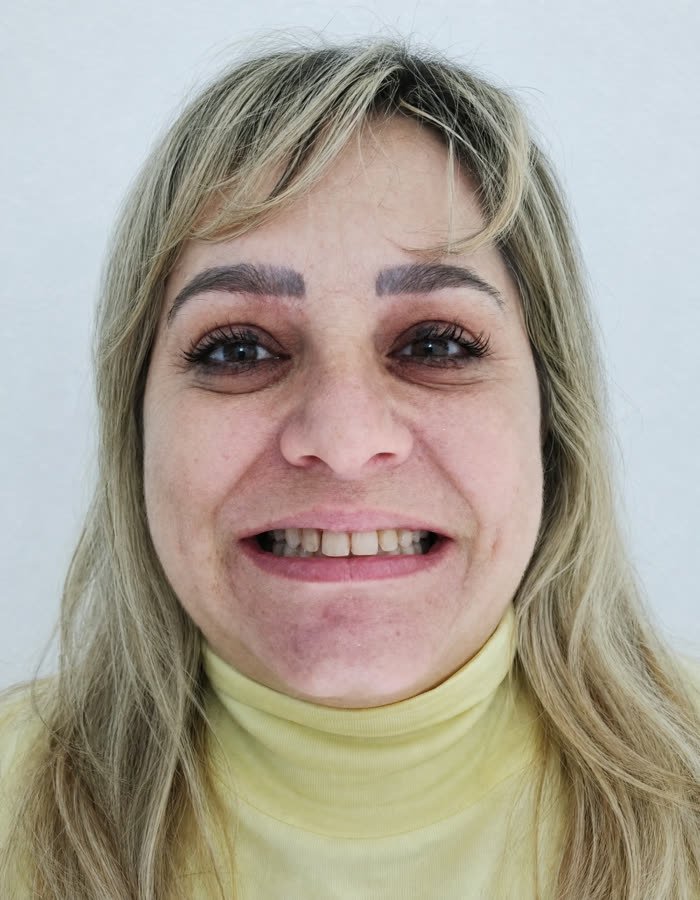 Paciente, caso 6, antes do tratamento